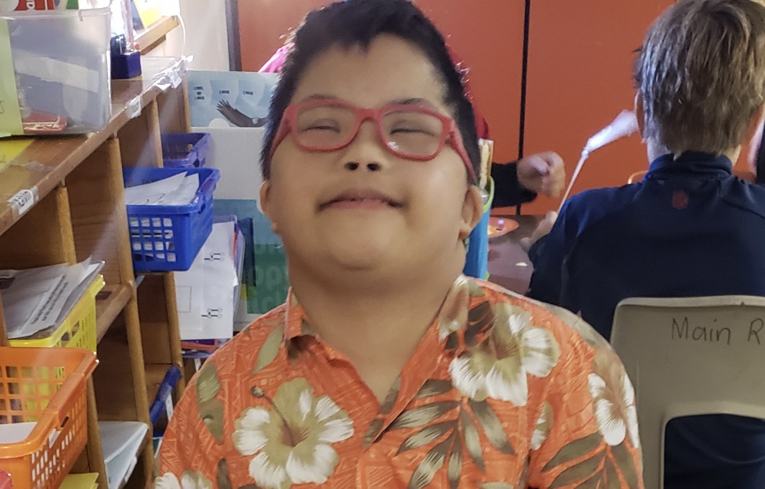 A young boy with Downs Syndrome is smiling for the camera.